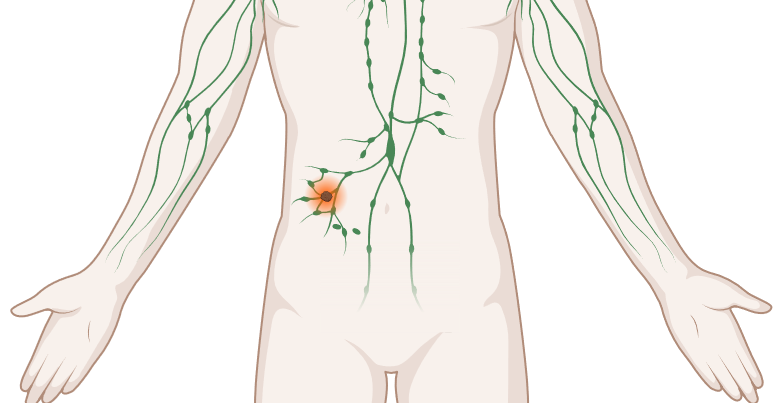 Cll Erkrankung - Article 1